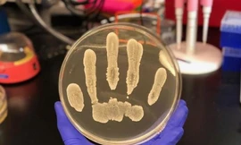  Khuẩn S. epidermidis đang phát triển trên một đĩa thạch (Ảnh: Science Daily) 