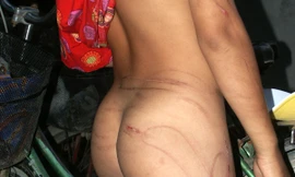 Những vết sẹo trên người cháu Thuận