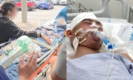 Nam sinh lớp 8 ở Hà Nội bị hành hung đến chấn thương sọ não khi chơi bóng rổ