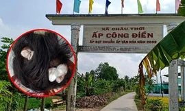 Thiếu nữ 16 tuổi ở Bạc Liêu bị người tình của mẹ đánh dập lá lách dẫn đến bất tỉnh