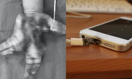 Từ vụ nam sinh 14 tuổi bị thương nặng do nổ điện thoại, cần lưu ý gì để đảm bảo an toàn?