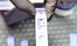 Người mắc COVID-19 ở Việt Nam có cần cách ly y tế không, phòng lây nhiễm thế nào?