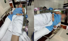 Nam sinh lớp 9 ở Hà Nội nhảy từ tầng 3 xuống nghi do bị bạn học trêu đùa, giễu cợt