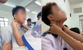 Trào lưu "bắt pen" đang rộ trên TikTok: Cảnh báo nguy hiểm, có thể gây ngưng tim