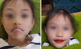 Tranh cãi vụ bé gái 5 tuổi xăm môi, phụ huynh khẳng định: "Từ giờ không phải đánh son"?