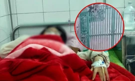 Vụ nữ sinh lớp 8 Thái Bình bị bố của bạn học đánh nhập viện: Xác định nguyên nhân ban đầu