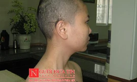 Một thiếu nữ bị cạo trọc đầu, xăm quái thú lên mặt ?