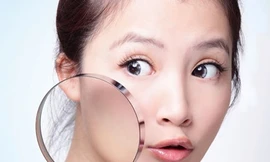 Mụn nhọt gây trầm cảm và ngược lại!