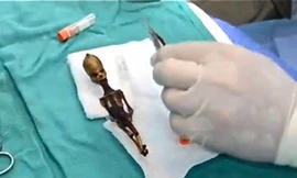 Khám 'sinh vật ngoài hành tinh' giống người