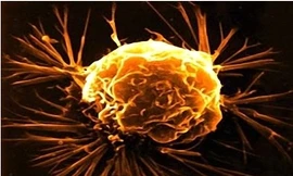 Vitamin D chống ung thư đại tràng