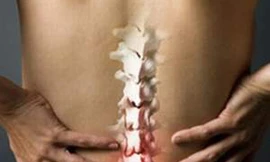 Cách điều trị đau cột sống thắt lưng