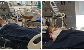 Nghịch phá tổ ong, 2 trẻ nguy kịch vì suy đa phủ tạng