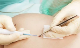 Ảnh minh hoạ: Internet