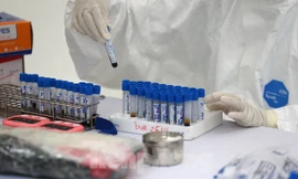 Việt Nam xuất hiện chủng virus mới gây COVID-19 