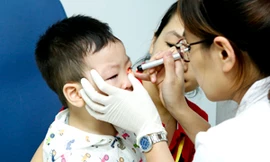 Phẫu thuật miễn phí cho 100 trẻ bị dị tật mắt lác