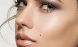 Những bất thường ở nốt ruồi có thể là ung thư da. Ảnh minh hoạ: Internet