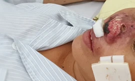 Bệnh truyền nhiễm bị lãng quên đang bùng phát trở lại