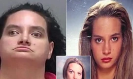 Bệnh kỳ lạ: Đẹp như ngôi sao bỗng trở nên xấu xí