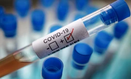 Ảnh minh hoạ: Getty Images