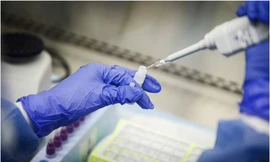 Ảnh minh hoạ: AP