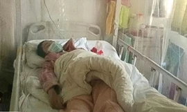 Cô sinh viên Wan Ruyi đang nằm trên giường chờ được điều trị ung thư tủy. (Ảnh: Weibo)