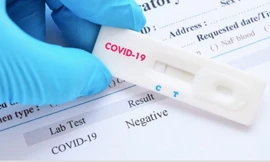 Séc phát hiện 80% dụng cụ xét nghiệm nhanh COVID-19 của Trung Quốc cho kết quả sai