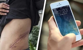 Bán thận để mua iPhone và iPad, một chàng trai đã phải nằm liệt giường suốt đời