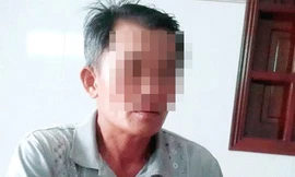 Người cắn 'của quý' hàng xóm thua kiện