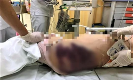 Cục trưởng Cục Trẻ em lên tiếng về vụ 'dì ghẻ' đánh bé gái 8 tuổi tử vong