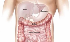 Phòng ngừa ung thư đại trực tràng