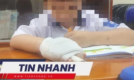 TIN NHANH: Nhà trường thông tin vụ học sinh lớp 1 bị cô giáo đánh gãy ngón tay; Cháy nổ kinh hoàng tại bãi đỗ xe sân bay