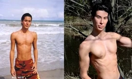 Chàng trai 128 lần phẫu thuật thẩm mỹ