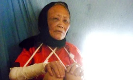 Đánh gãy hai tay mẹ vì 'dám' làm mất chim