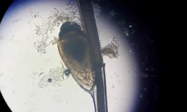 Rận ký sinh chi chít ở nách người đàn ông suốt 2 tháng