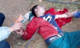 Rơi từ mái nhà, người đàn ông bị xà beng đâm xuyên ngực