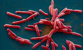 Cứu bé gái 4 tuổi nhiễm 'vi khuẩn ăn thịt người'