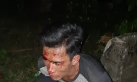 Nhiều công an nguy cơ phơi nhiễm HIV khi vây bắt 'sưa tặc'