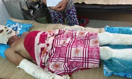 Phát nổ do rò rỉ khí ga trong đám tang, 5 người bỏng nặng