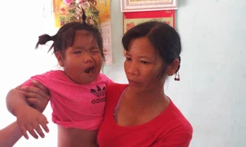 Công an vào cuộc vụ cô giáo bị tố đánh trẻ méo miệng