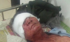 Ông Tùng đang điều trị tại Bệnh viện đa khoa tỉnh Thanh Hóa 