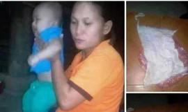 Bệnh viện bác bỏ thông tin ‘bác sĩ bỏ quên gạc trong bụng bệnh nhân’