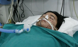 Bệnh nhân Chung đang điều trị tại bệnh viện Việt Đức