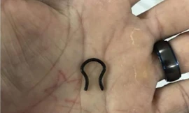 Bị mất chiếc khuyên mũi từ 5 năm trước, đến giờ mới tìm được ở nơi không thể ngờ tới