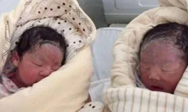 Người phụ nữ sinh đôi xong vẫn thấy trong bụng “có cử động”, sự thật rất khó tin