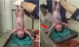 Video em bé "siêu nhân", vừa ra đời đã nhấc bổng khay kim loại như lực sĩ khiến y tá kinh ngạc
