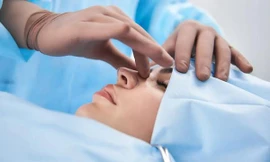 Tự phẫu thuật thẩm mỹ thu gọn mũi theo clip YouTube, thanh niên phải đi cấp cứu vì biến chứng này