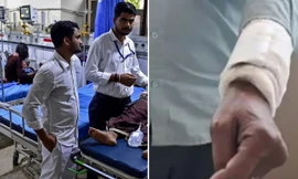 Chuyện khó tin ở Ấn Độ: Bác sĩ nhầm, phẫu thuật cho người cha đưa con vào viện