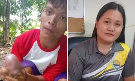 Chú heo con ở Philippines có khuôn mặt giống người, bác sĩ giải thích thế nào?