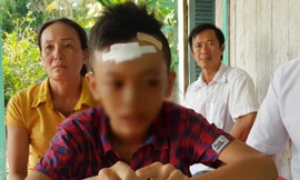 Nam sinh lớp 7 bị bạn đánh chảy máu đầu, ngất xỉu 