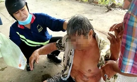 Xe cẩu va vào đường dây trung thế, một người đàn ông bị bỏng nặng